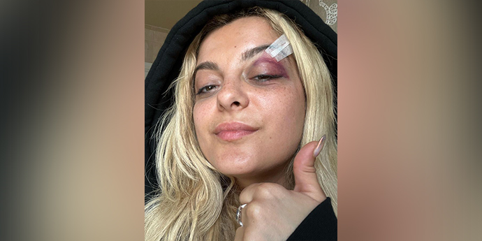 Bebe Rexha hospitalized after being struck by phone during New York City concert 